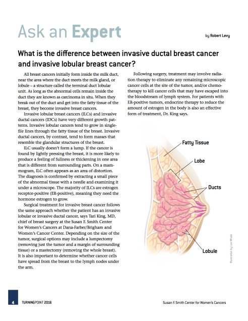 ask-an-expert-idc-and-ilc-explained-by-robert-levy-dana-farber